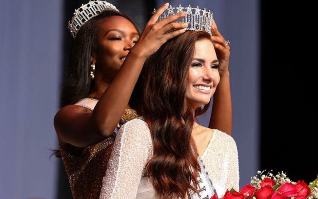 Miss desenvolve câncer de pele após usar unhas em gel por tempo demais