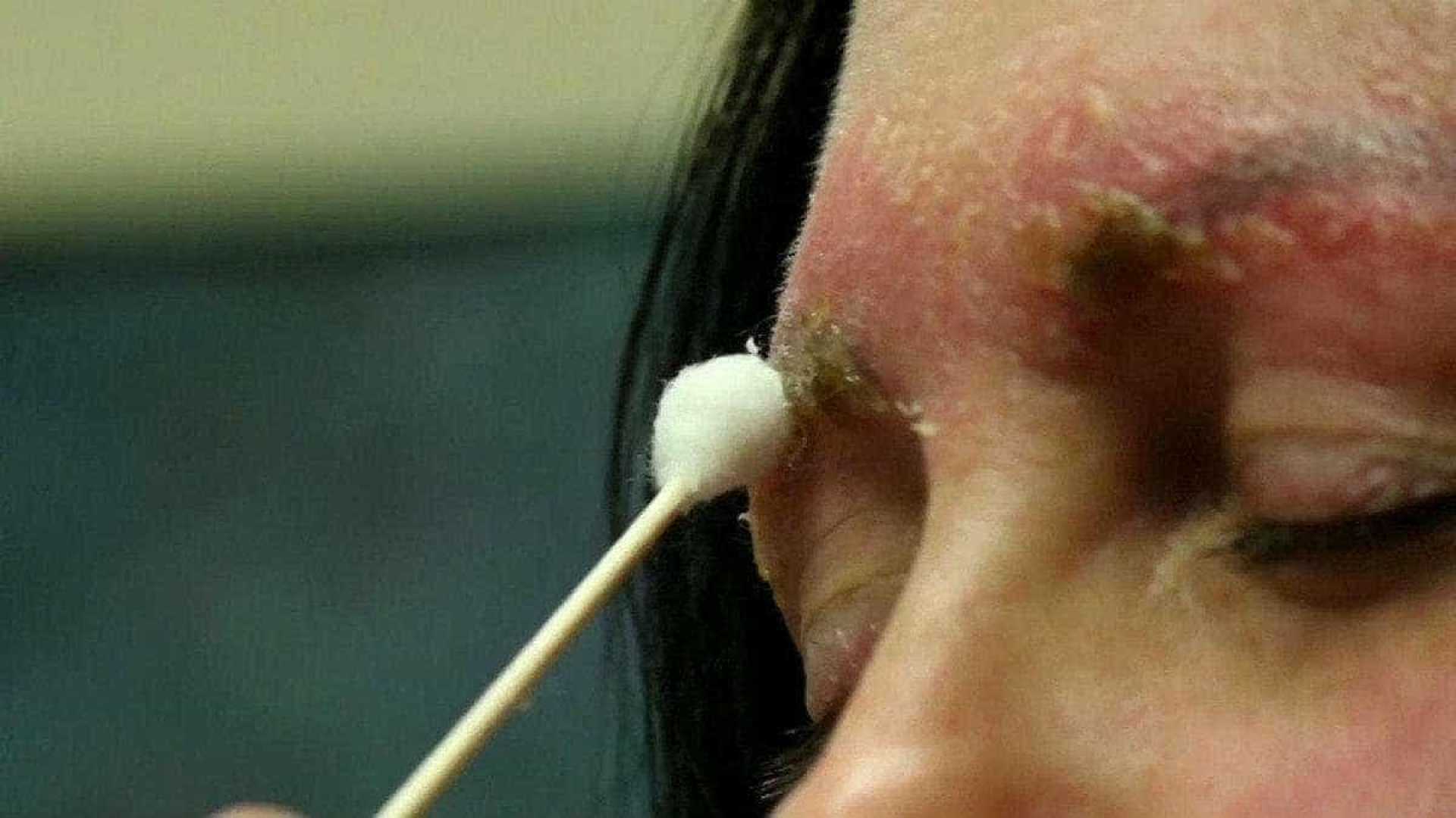 Mulher quase morre ao pegar infecção na sobrancelha após microblading