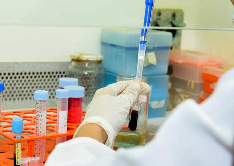 FMT participa de estudo que vai testar novo exame para tuberculose