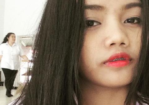 Jovem tenta remover tatuagem com produto comprado na internet e resultado é chocante