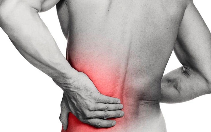 Mitos e verdades sobre a hérnia de disco