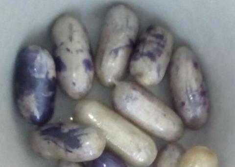 Casal brasileiro é preso ao tentar entrar em Israel com drogas escondidas no corpo 