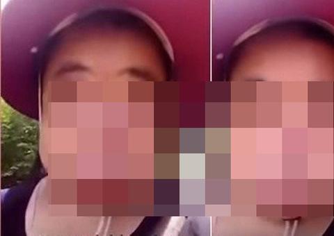 Mulher fica com rosto deformado ao tentar tirar mel de colmeia