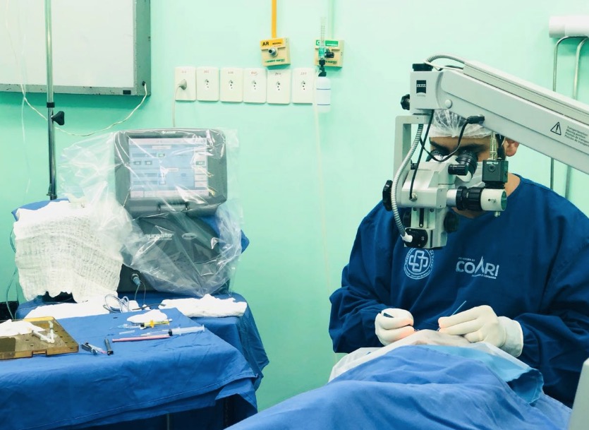 Mutirão de cirurgias para catarata beneficiam mais de 60 coarienses 
