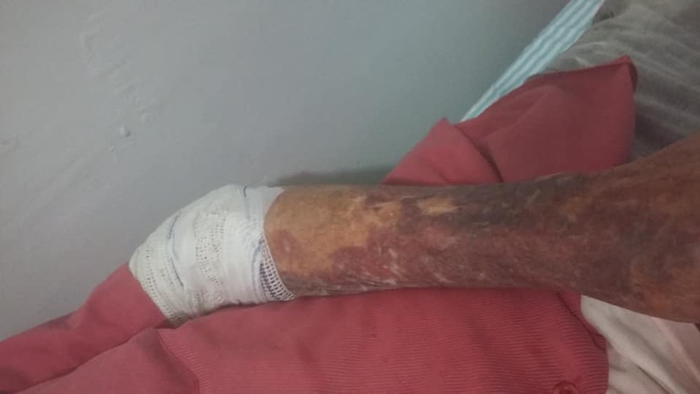  Homem é preso suspeito de agredir idoso de 90 anos