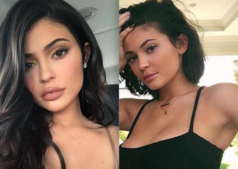Kylie Jenner surge diferente e choca ao revelar que abandonou preenchimento labial