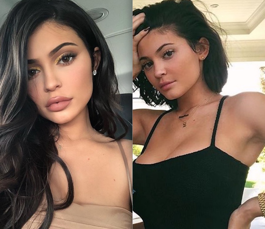 Kylie Jenner surge diferente e choca ao revelar que abandonou preenchimento labial