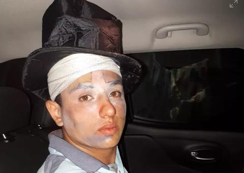 Vestido de palhaço, jovem invade casa da ex e agride família com azulejo