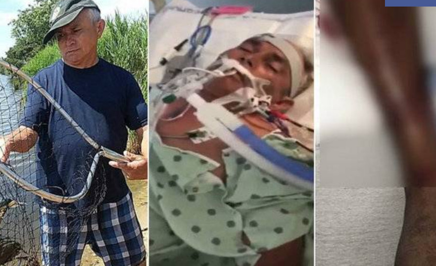 Homem pode perder braço pela ação de bactéria comedora de carne