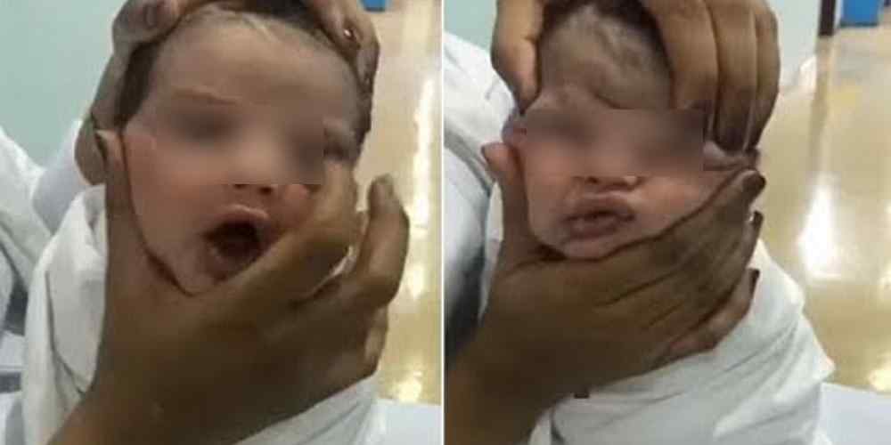 Enfermeiros são demitidos após serem filmados espremendo rosto de recém-nascido