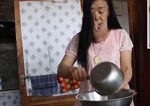 Mulher humilhada por ter tumor facial compartilha vida na internet e é amparada