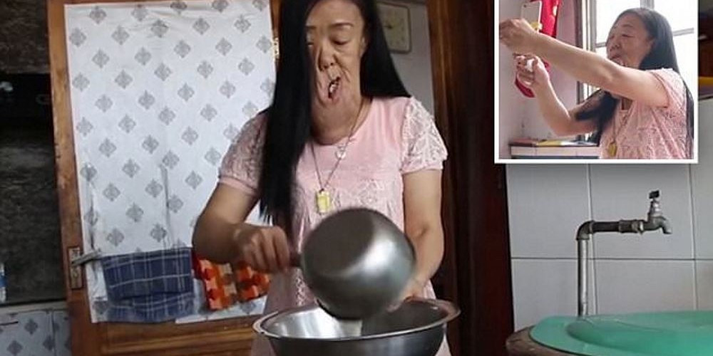 Mulher humilhada por ter tumor facial compartilha vida na internet e é amparada