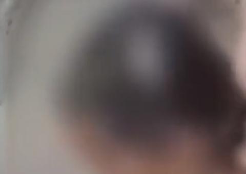  Pai e madrasta são condenados por raspar cabelos de filha