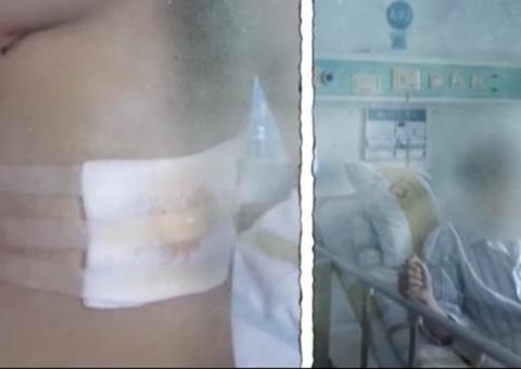 Bizarro! Homem sofre lesão no pulmão ao se espreguiçar pela manhã