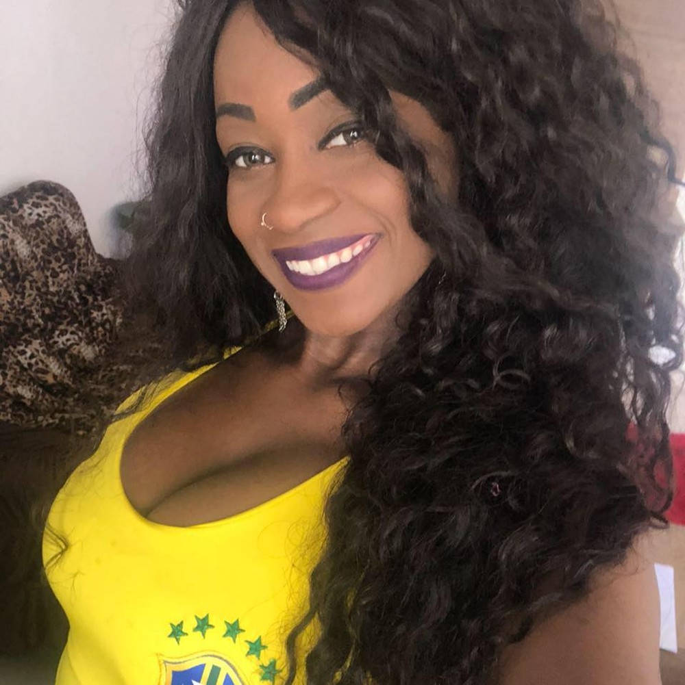 Modelo morre após realizar mesmo procedimento estético que bancária no Rio de Janeiro