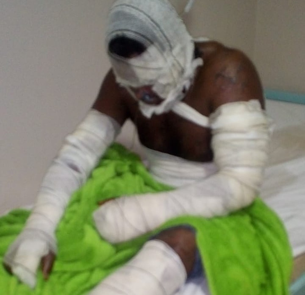 Menino de 7 anos morre e pai fica gravemente ferido em incêndio