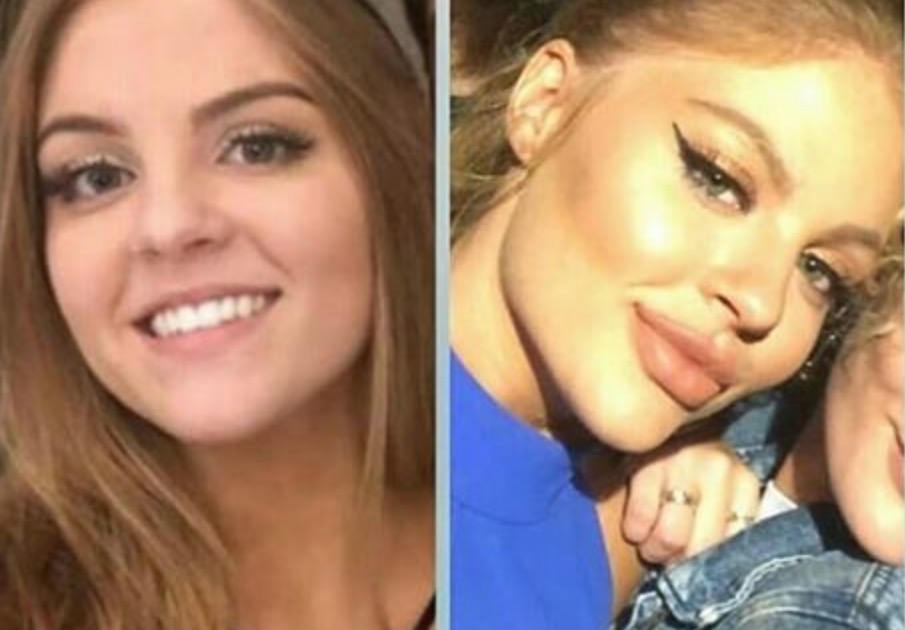 Esposa de Whindersson Nunes é criticada por abusar de preenchimento no rosto; veja antes e depois