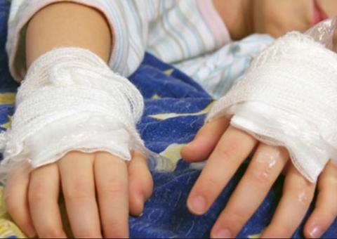 Criança de 3 anos é internada em estado grave após ser espancada e queimada pela mãe