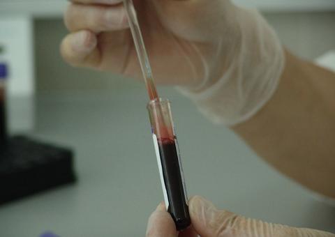 Ministro do STF defende coleta de DNA da população para investigação de crimes