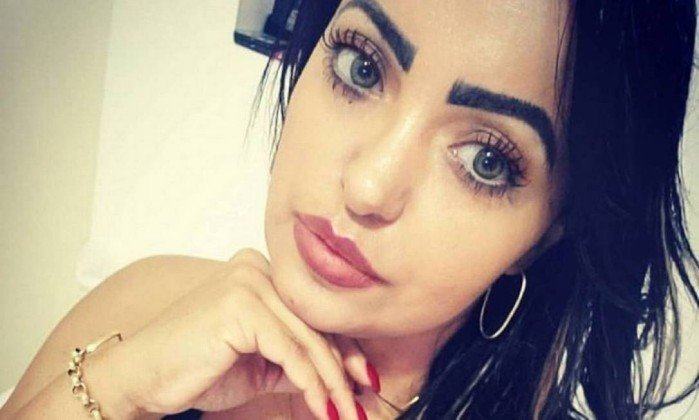 Ex-paciente da 'Doutora Enfermeira' sofre com infecção nas nádegas