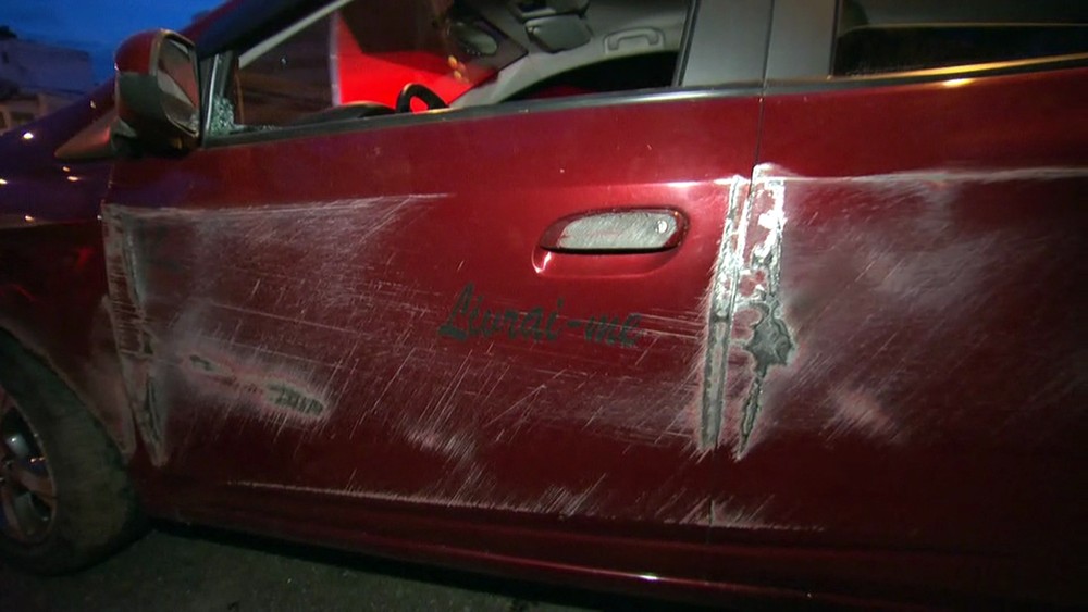 Estudante ferido em troca de tiros no Rio tem braço amputado