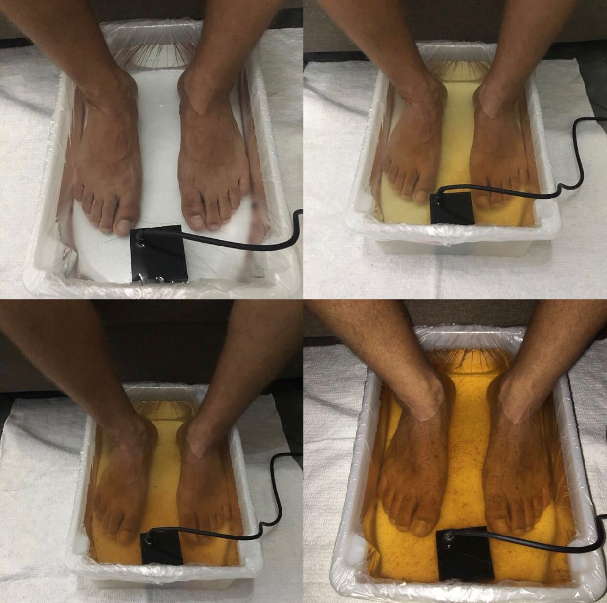 Já ouviu falar de desintoxicação pelos pés? Conheça e saiba como funciona