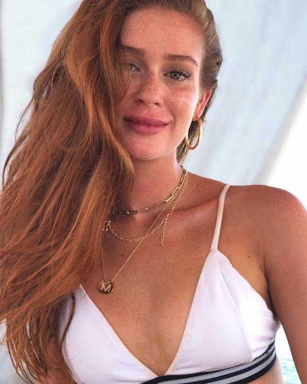 Boca de Marina Ruy Barbosa chama atenção e internautas desconfiam de preenchimento labial