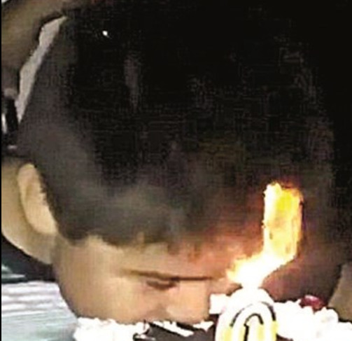 Vídeo mostra cabelo de criança pegando fogo ao tentar apagar velas de aniversário 