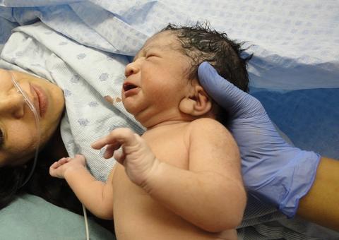 Com ‘epidemia’ de cesáreas, 4 em cada 10 bebês nascem antes do tempo ideal