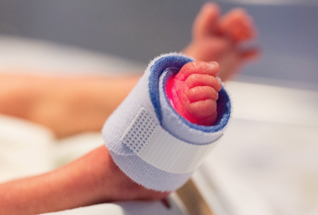 Com ‘epidemia’ de cesáreas, 4 em cada 10 bebês nascem antes do tempo ideal