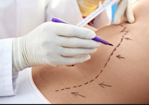 Estudante que teve intestino perfurado em lipoaspiração recebe alta