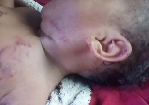 No Amazonas, polícia detém homem suspeito de torturar com mordidas bebê de 7 meses 