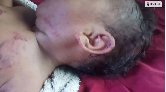 No Amazonas, polícia detém homem suspeito de torturar com mordidas bebê de 7 meses 