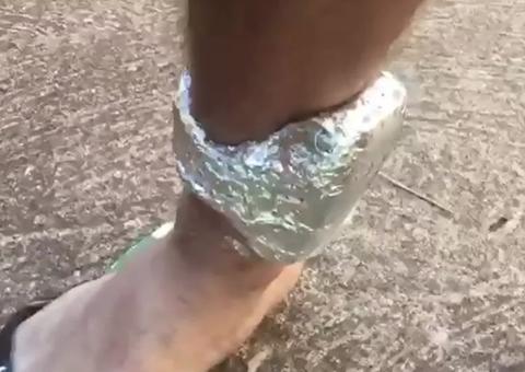 Preso do semiaberto usa papel alumínio para bloquear sinal de tornozeleira eletrônica