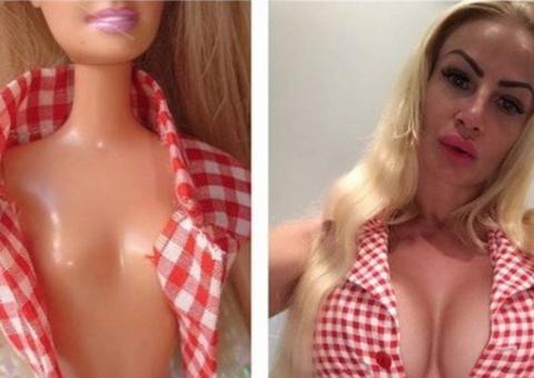 Mulher desembolsa R$ 76 mil para remover seis costelas e ter cintura da Barbie