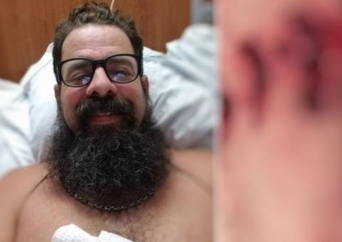 Homem vai parar no hospital com dores e descobre bactéria que devora carne