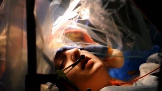 Mulher conta piadas durante cirurgia para remover tumor do cérebro