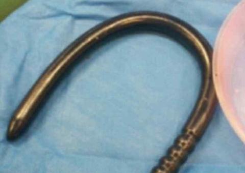 Homem perfura intestino após 'perder controle' com brinquedo sexual