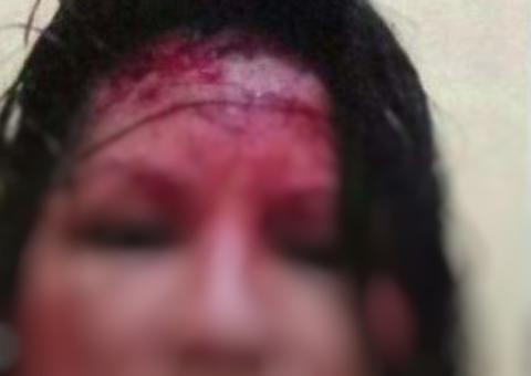 Professora fica em estado grave após ser espancada e torturada pelo marido no Amazonas