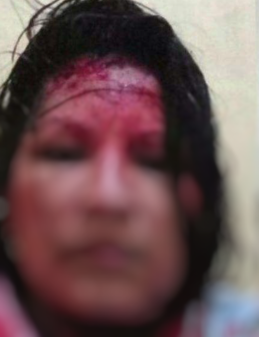 Professora fica em estado grave após ser espancada e torturada pelo marido no Amazonas