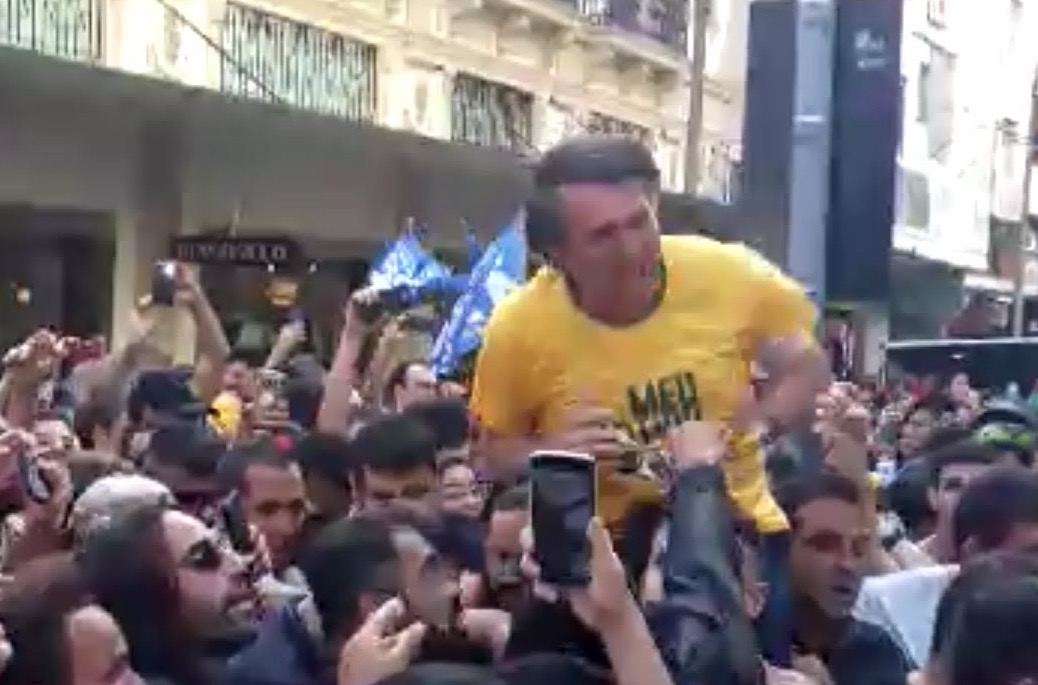 Foto mostra abdômen de Bolsonaro cortado de ponta a ponta após cirurgia