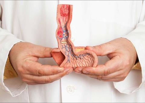 Mortes por câncer chegarão a 9,6 milhões em 2018, indica relatório