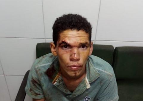 Jovem esfaqueia mãe grávida, mata cachorro e come pedaço do coração do animal