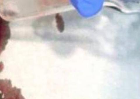 Foto de tartaruga morta retirada da vagina de paciente viraliza na internet