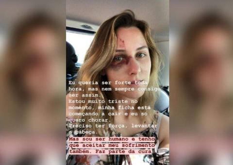 Brasileira agredida pelo namorado nos EUA faz alerta sobre relacionamento abusivo