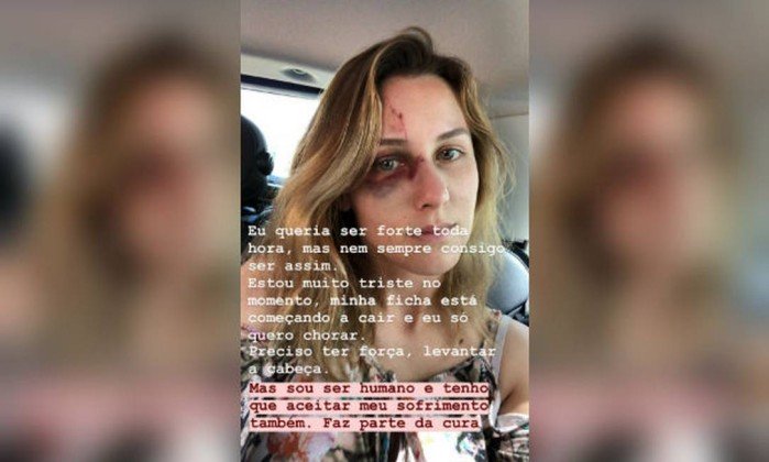 Brasileira agredida pelo namorado nos EUA faz alerta sobre relacionamento abusivo