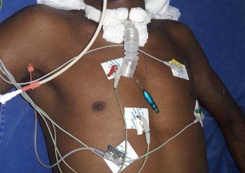 HPS João Lúcio procura família de vítima internada por agressão