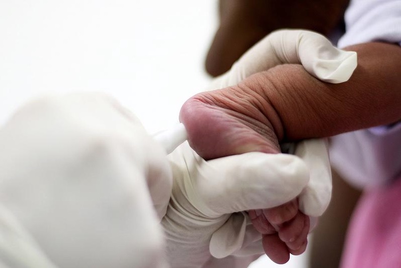 Policlínica Codajás passa a ter acompanhamento nutricional a pacientes com doença que limita a ingestão de proteína  