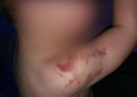 Polícia investiga professor suspeito de agredir bebê em creche