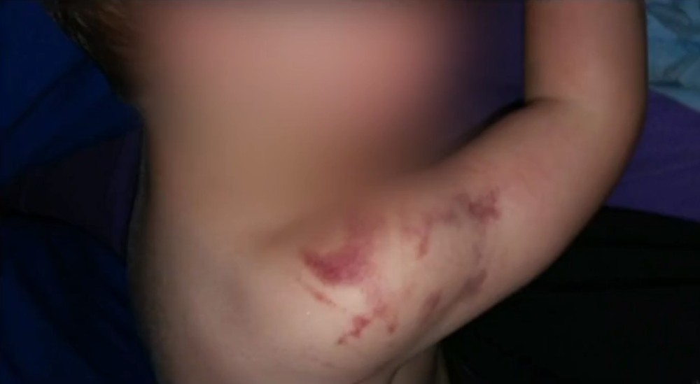 Polícia investiga professor suspeito de agredir bebê em creche